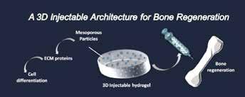 However, metal implants poorly integrate with neighbouring tissues and can fail due to infection or fatigue loading.