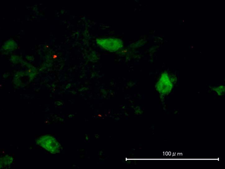 Double immunostaining by anti-gfp and anti-bdnf antibodies in the