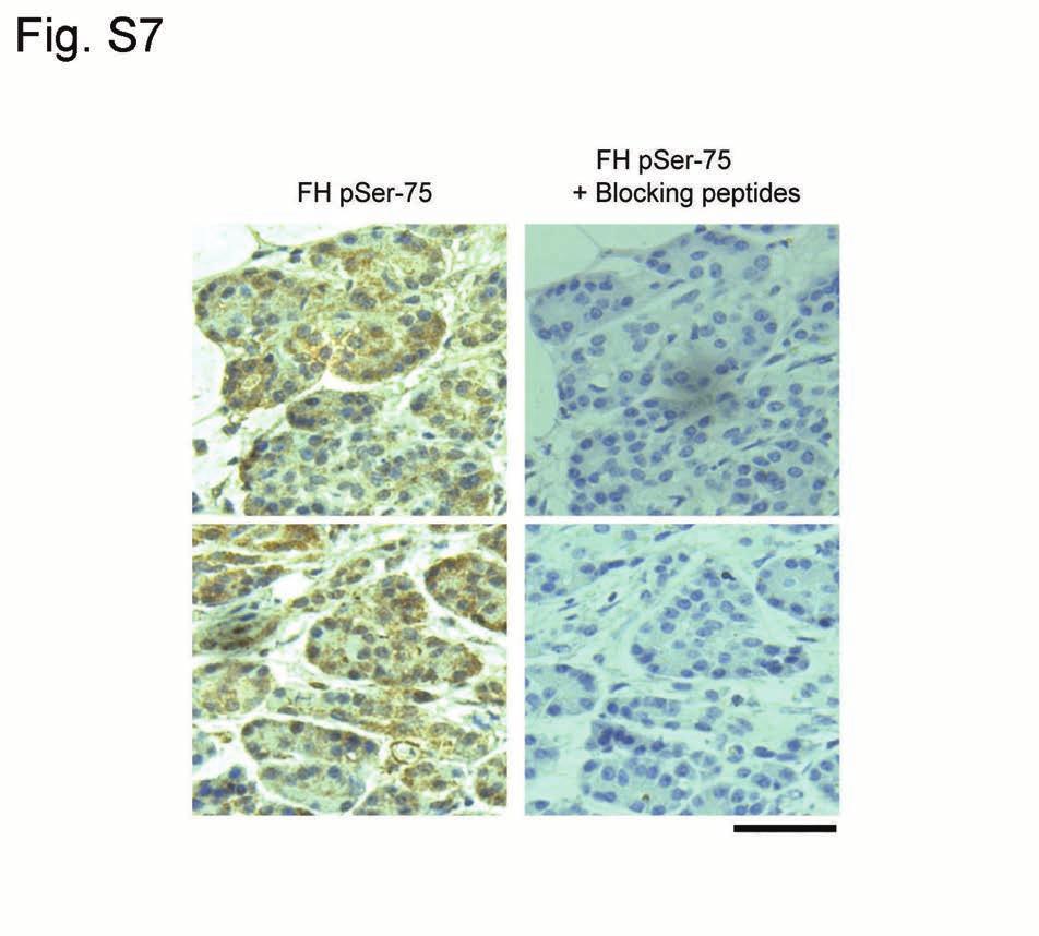 Supplementary Figure 7 Inhibition of FH S75 phosphorylation by OGT is required for tumorigenesis.
