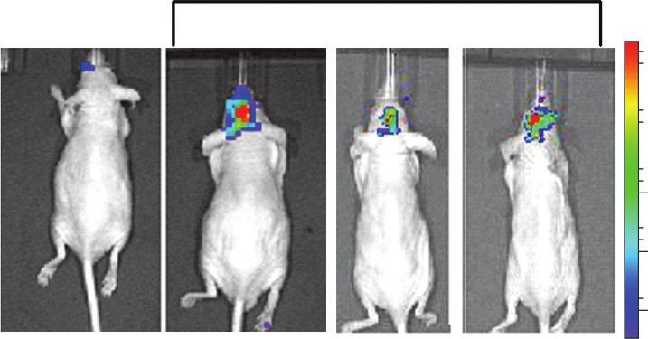 (b f) 1 5 U87-Fluc/NF-Gluc glioma cells were implanted intracranially in nude mice.