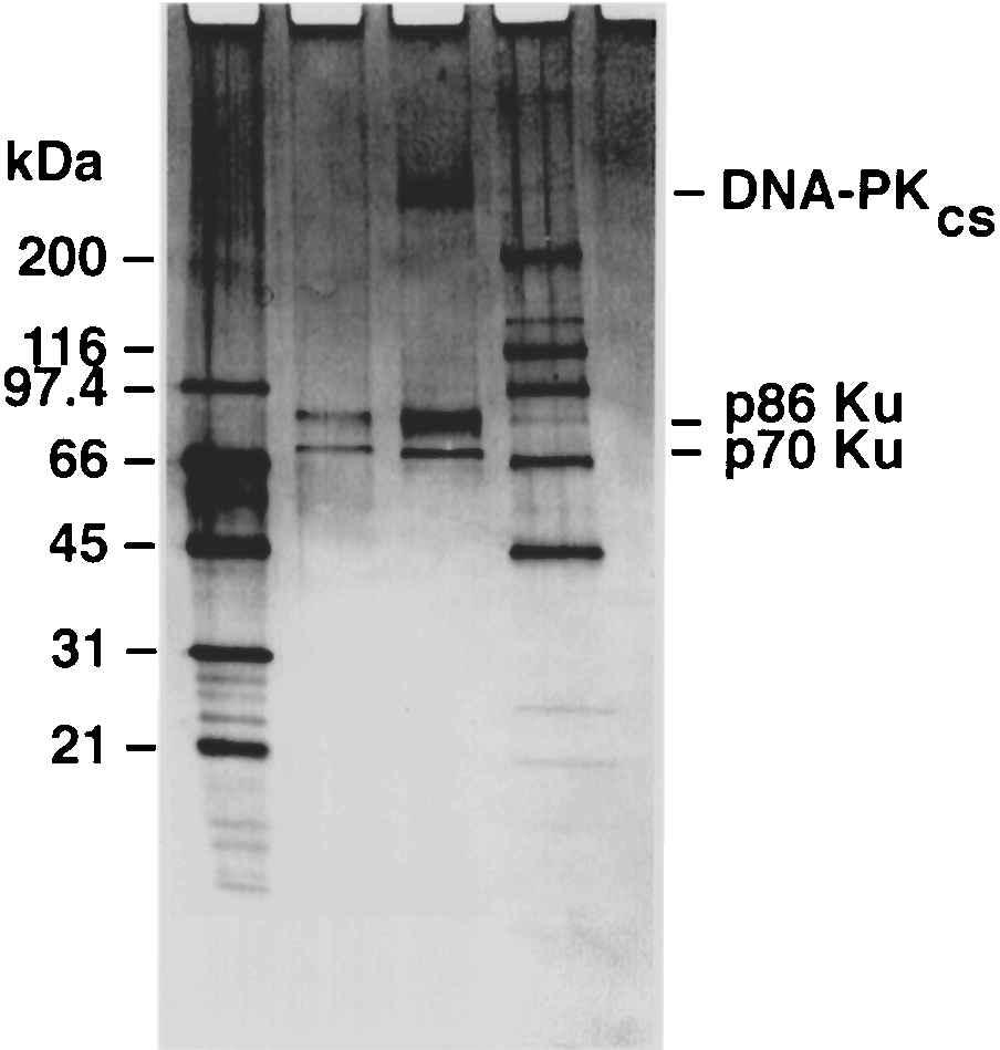 5 0 TO 3 0 SSDNA EXONUCLEASE ACTIVITY IN KU PROTEIN 595 Figure 2. Silver-stained 4 20% gradient SDS polyacrylamide gel analysis of the Ku proteins.