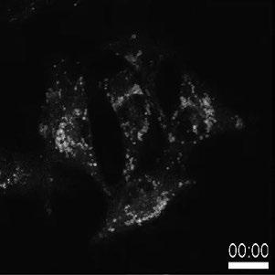 Video 1. Rab7 + endosome enlargement by YM201636 treatment. Time-lapse confocal microscopy of live MDA-MB-231 cells stably expressing mrfp-rab7.