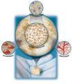 Inc.) Collagen sponge Keratinocytes, Fibroblasts Laserkin, Hyalograft (Fidia Adv.