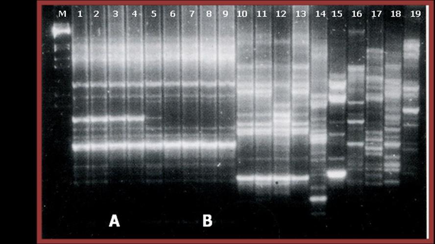 <BOX A1R- PCR 1.