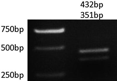 MFEprimer 211 Fig. 10 Electrophoresis analysis of the two transcript variants of the mouse Nnat gene not be considered as nonspecific amplicon.