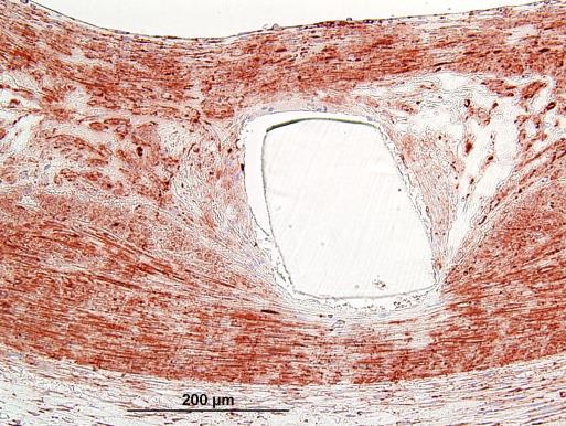 stain At 36 months, SMCs are well organized and phenotypically