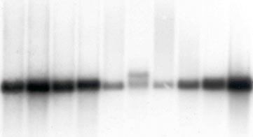 2 General remarks: 1. Probing of Sigma s Mouse Multiple Tissue Northern Blot has been optimized using PerfectHyb Plus hybridization buffer (Product No. H7033).