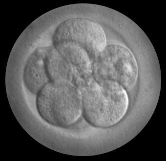 As development proceeds, the cells undergo differentiation and become specialised in structure, making them perfectly adapted for carrying out a particular function.