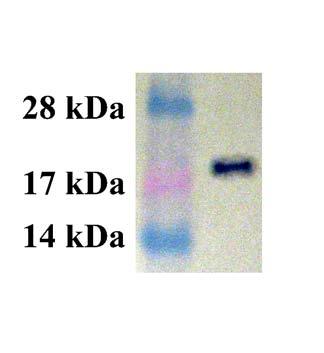 Example of Results The following figure demonstrates typical results seen with Cell Biolabs RhoC Activation Assay Kit. One should use the data below for reference only.