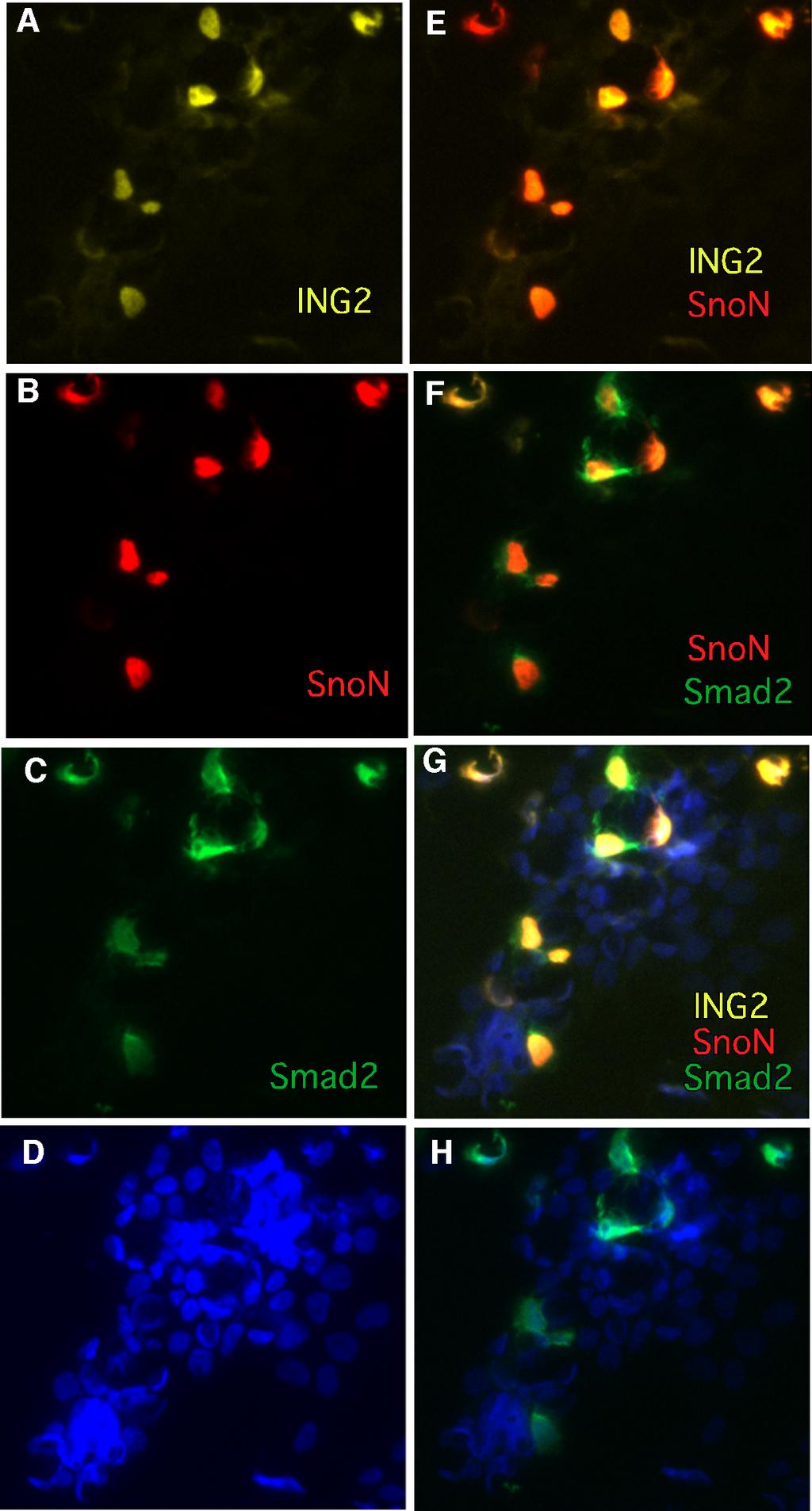 Sarker et al.. Supplementary Fig. 6. ING2 colocalizes with SnoN and Smad2 in the nucleus.