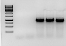 RNA extraction, reverse transcription, gene amplification from cdna, subcloning, sequencing Fv SEQUENCE