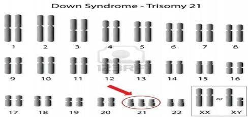 Karyotype Look at the 23rd set of chromosomes to see