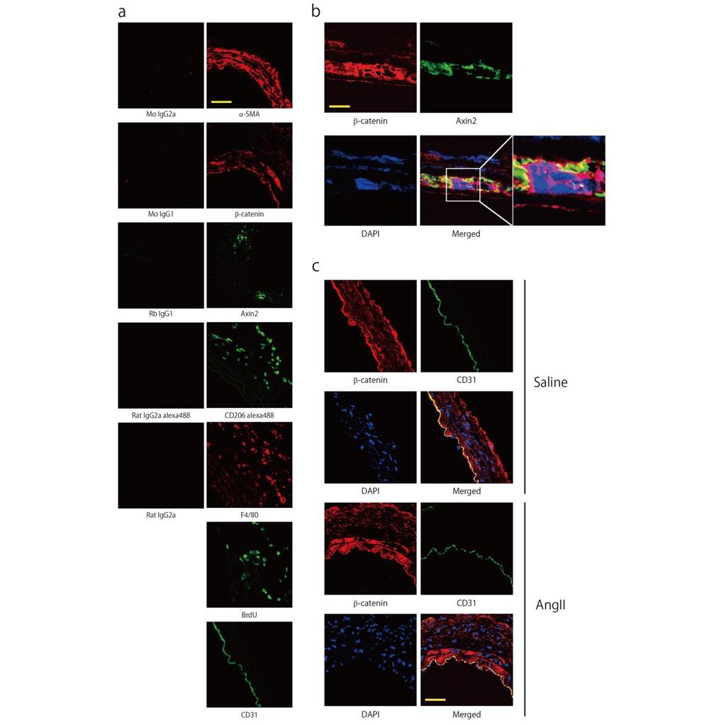 Supplementary Figure 2. -catenin signaling is activated in aortic media after AngII-infusion.
