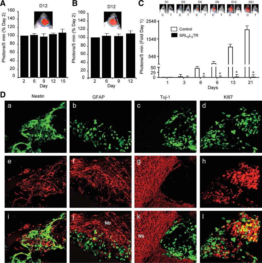 Hingtgen, Kasmieh, van de Water et al. 839 Figure 5. Stem cells efficiently deliver SRL O L 2 TR to eradicate intracranial glioblastoma.