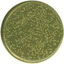 Confluency Streaking Used by scientists to grow massive amount of bacteria on the plate.