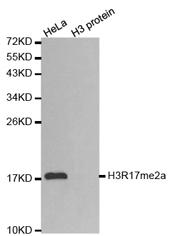 Immunohistochemistry of paraffin-embedded human lung cancer tissue using Histone H3R17
