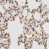 Immunohistochemistry of paraffin-embedded human kidney cancer tissue using Histone H3R17 