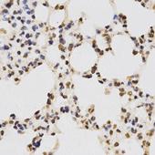 Immunohistochemistry of paraffin-embedded rat lung tissue using Histone H3R17 