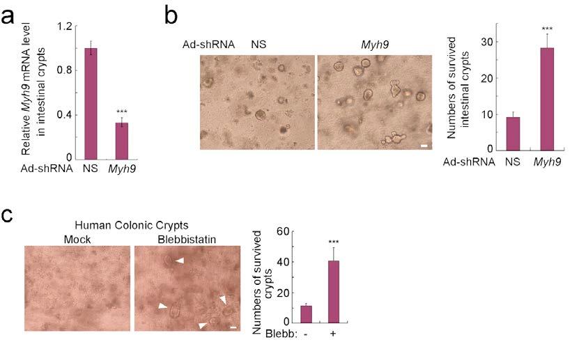 Supplementary Figure 4 Supplementary Figure 4 Knockdown of Myh9 expression using adenovirus-based shrna promoted the survival of isolated crypts.