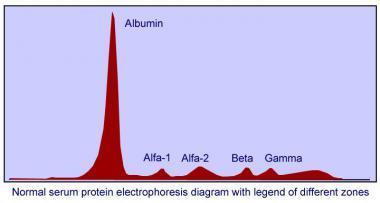 Electrophoresis of human serum + electrode -