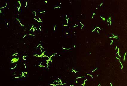 Immunofluorescence We use antibody that is bound to a fluorochrome (fluorescent compound) usually fluorescein isothiocyanate (FITC) Fluorescent treponemal antibody absorption (FTA-ABS) test