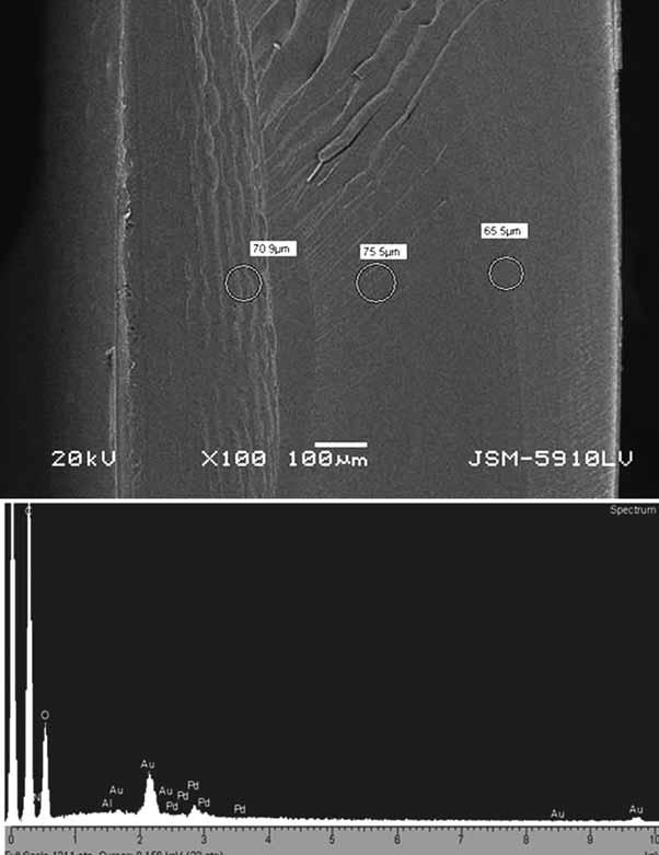 SEM and EDS analysis of explanted IOLs A Fig. 7 - (A) Photograph of the center of the opacified lens. (B) Energy dispersive spectroscopy findings performed on the center of the opacified lens.