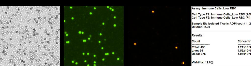 Bright field and fluorescent images are acquired and analyzed 4. Select assay and click count 6.
