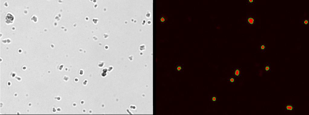 Debris Bright Field Fluorescence Lysed Cells Utilize different counting chambers that can handle different volumes For precious samples such as circulating tumor cells (CTC), infiltrating T cells, or