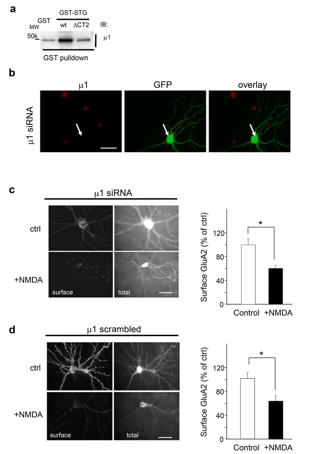 Supplementary Figure S7 AP-1 interacts with STG but does not inhibit the NMDA induced removal of surface AMPA