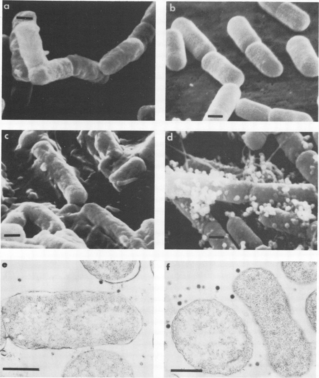 VOL. 15, 1975 SEM VISUALIZATION OF PHAGE ADSORPTION 1501 Downloaded from http://jvi.asm.org/ FIG. 2. Comparison of glutaraldehyde fixation to glutaraldehyde, post-osmium fixation by SEM and TEM.
