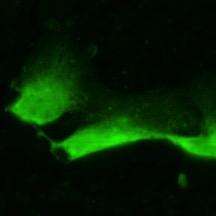 Neurons Astrocytes β-tubulin GFAP III 25-30%