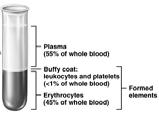 The Composition of Blood Plasma Plasma Basics Makes up about 55% of whole blood Water makes up about 92% of plasma Has more protein and oxygen than interstitial fluid Plasma proteins fall in three