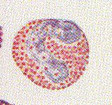 Eosinophils (granulocyte): similar to neutrophils. Involved in asthma, allergies.