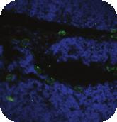 Flow Cytometry, IHC, IF A B C D Figure: Immunofluorescent and Immunohistochemical staining using Anti-Carcinoembryonic antigen (Arcitumomab), Human IgG1 Antibody (Cat. No.