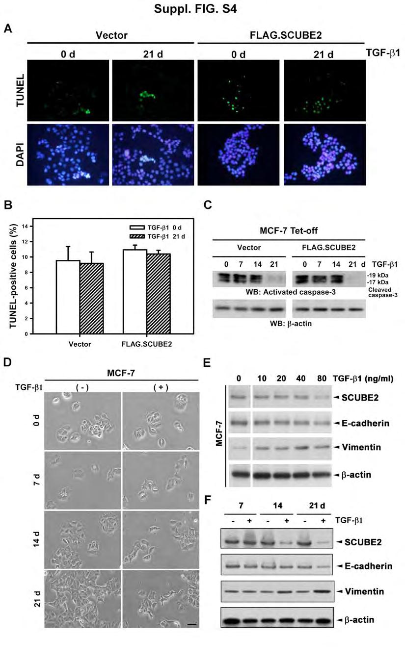 Fig. S4. Effect of TGF-b1 treatment on apoptosis and EMT in MCF-7 cells. (A,B) TUNEL assay.