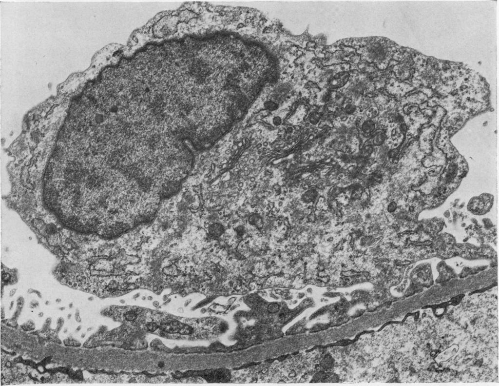 3 Electron micrograph of normal glomerular epithelial cell showing good preservation of the subcellular details.