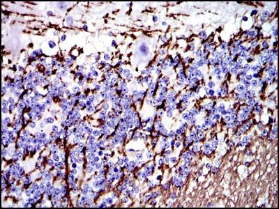 of paraffin-embedded cerebellum tissues using Myelin Basic Protein mouse mab with DAB staining.
