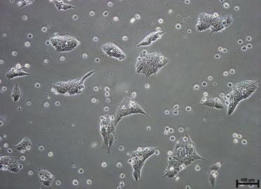 frozen as single cells in   
