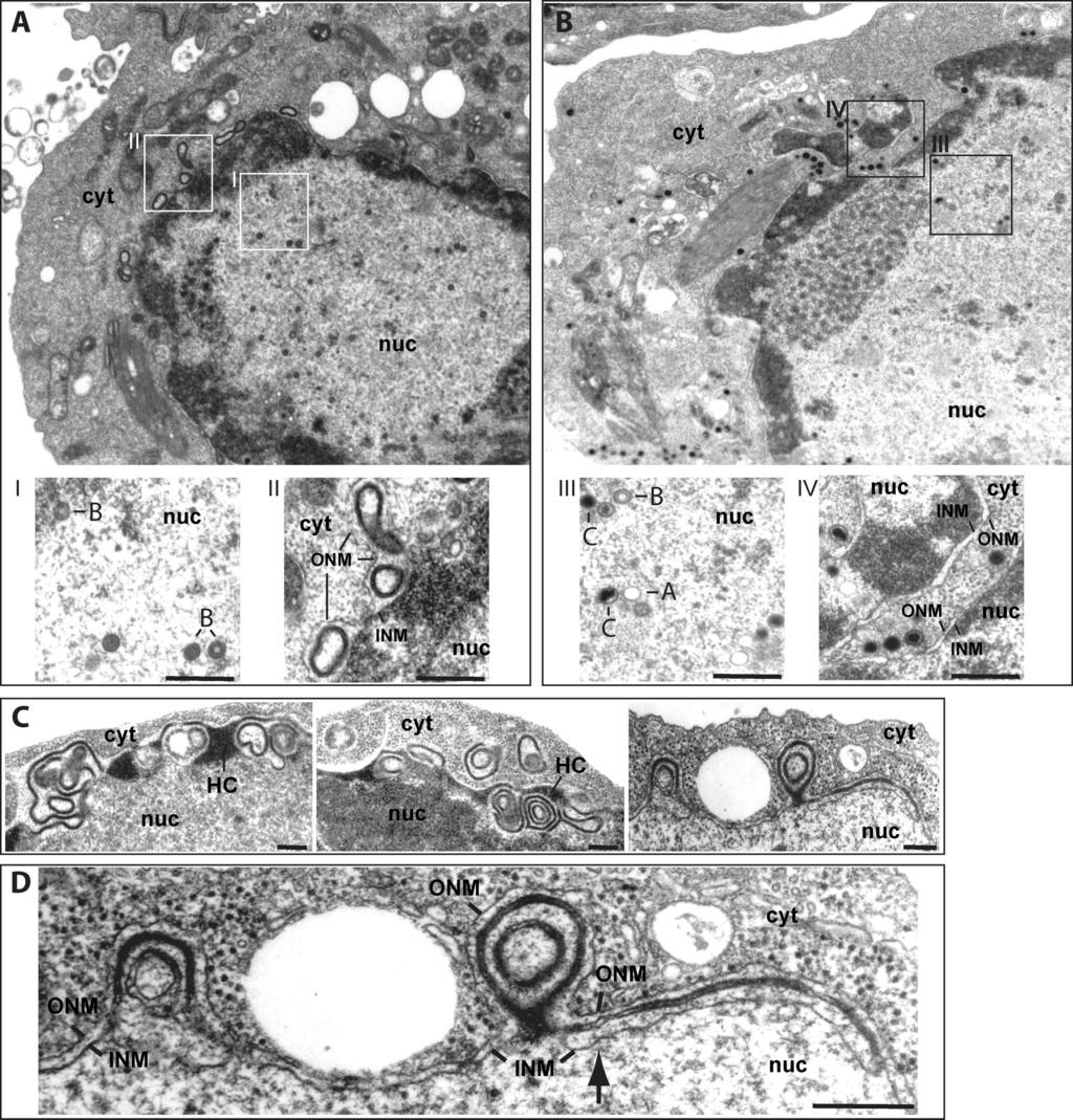 VOL. 83, 2009 EBV BGLF5 AND VIRUS MATURATION 4957 FIG. 3. Electron micrographs of induced 293/ BGLF5 (A, C, and D) and 293/ BGLF5-C cells (B).