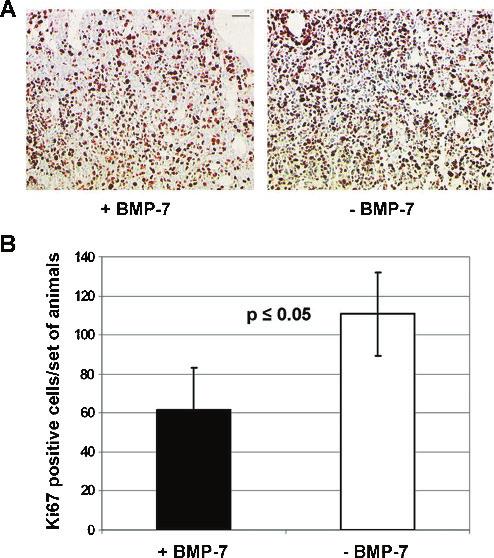 Figure W1. Immunohistochemical analysis of Ki67 in experimental gliomas. Mice brains were dissected 10 days after starting BMP-7 (100 μg/kg per day) or control buffer treatment (± BMP-7).