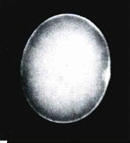 c. 1987 above: One of Lans Taylor s first fluorescence images: a still of a sea urchin egg injected with fluorescently labeled actin, fertilized, and videotaped to capture the dynamics.