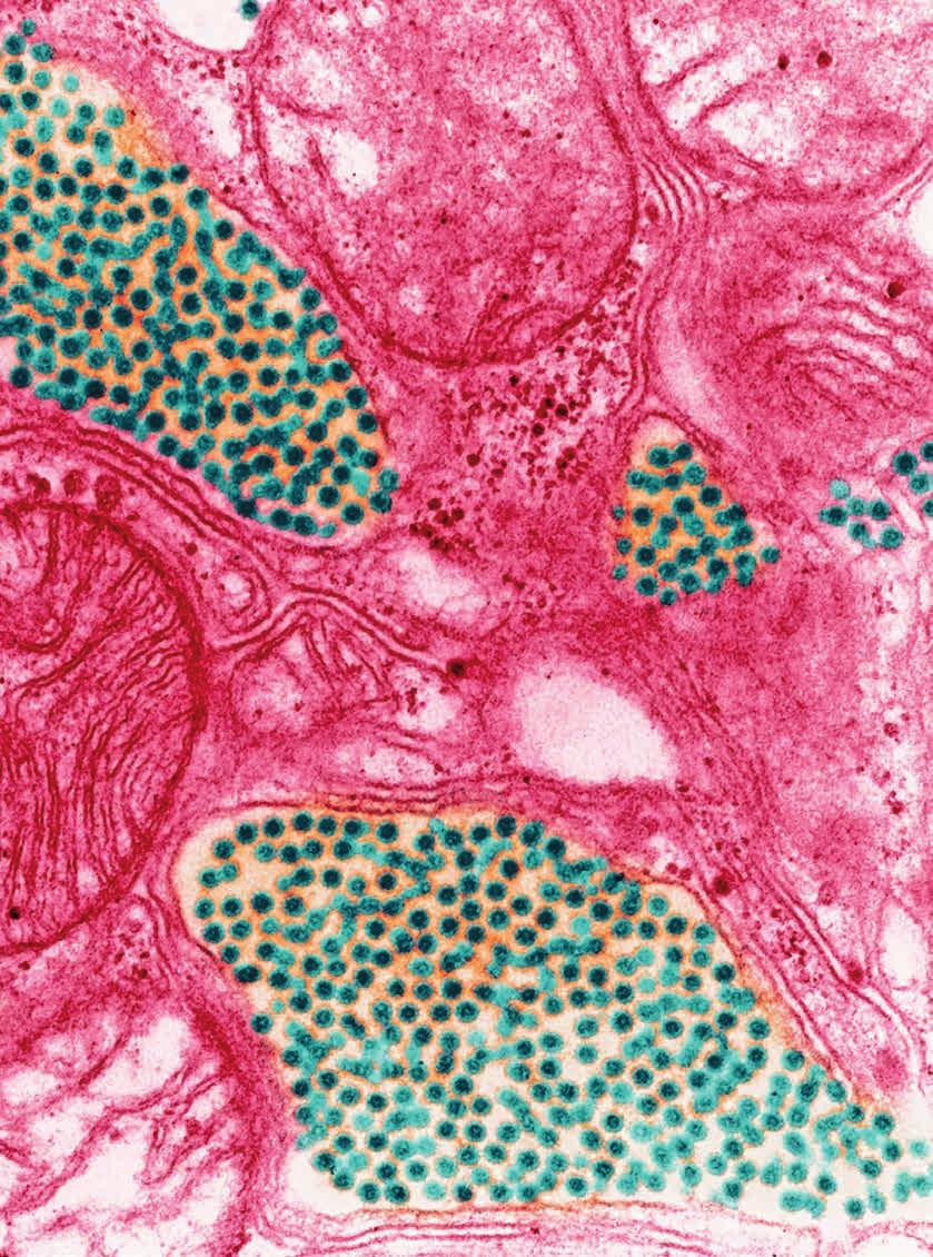 Eastern equine encephalitis virus in the salivary gland of a mosquito. TAKING OUT THE BITE Last September, thousands all over Norfolk County, Mass., stayed indoors at sundown.