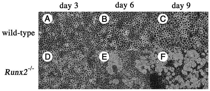 Adipogenic changes in Runx2 / chondrocytes 419 Fig. 1. Morphological changes of chondrocytes in culture. Chondrocytes isolated from the ribs of wild-type (A-C) and Runx2 / (D-F) embryos at E18.
