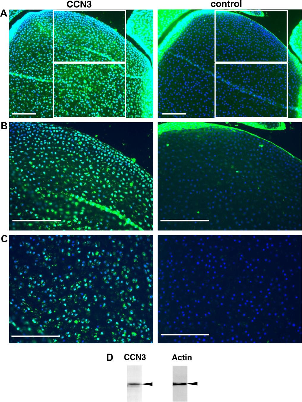 D. Janune et al. / FES Letters 585 () 333 34 335 Fig.. Distribution of CCN3 protein in rat developing epiphyseal cartilage.