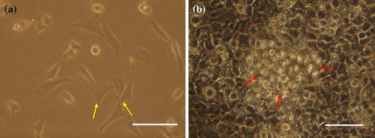 796 UEKI et al. FIGURE 2. Cell appearances in cultured growth plate chondrocytes. Photomicrographs of chondrocytes in monolayer culture on day 4 (a) and on day 11 (b).