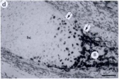 c, darkfield illumination showing collagen type x expression in hypertrophic chondrocytes.