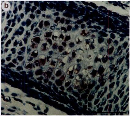 Cell Growth A Difterentiation 763 a Fig. 4. Localization ot MMP-1 protein in tissues ot a 1 7.5-clay p.c. enli)ryo.