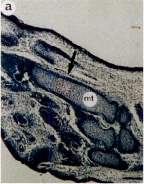 c and d, parallel sagittal sections of the clavi(le. For ininiunohistochemical analysis, antisera raised against GST-l lagc nase ) a-c) or GST d) were used. nit, nietatarsal i)one; (1, clavicle.