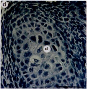 Discussion In this study, we demonstrate that interstitial cobbagenase is first expressed at day 14.5 during mouse development and that expression is restricted to areas of bone formation.