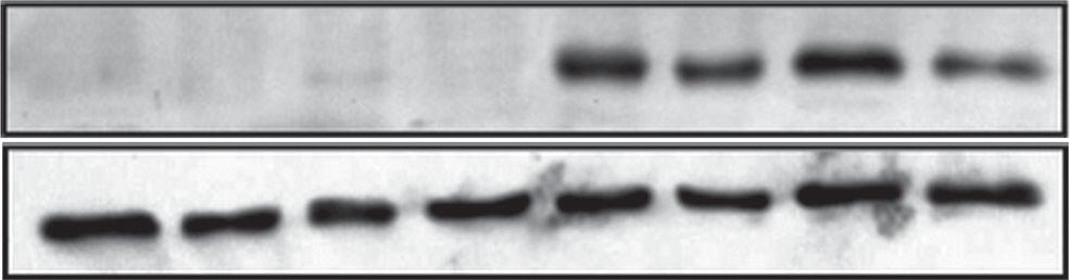 IL-1α and ELF3. NFκB also regulates LN2 expression As mentioned earlier, our results suggest that ELF3 is not the only transcription factor involved in the IL-1α-mediated LN2 induction.